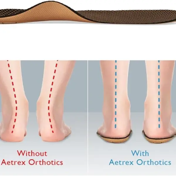 Aetrex L400 Women’s Pro-Shox Orthotics Arch Support Inserts – Shock Absorbing Plantar Fasciitis Relief Insoles for Women for Walking, Workouts and All-Day Support