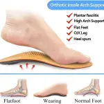 JSEIAJB Leather Orthotic Insole for Flat Feet Arch Support Orthopedic Shoes Sole Insoles for Men and Women Shoe Pad